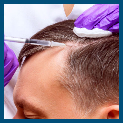 PRP Hair Treatment
